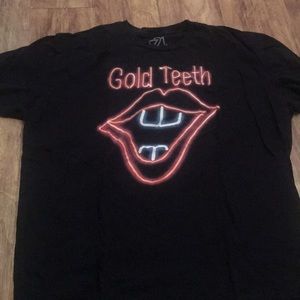 Gold Teeth Black T-Shirt